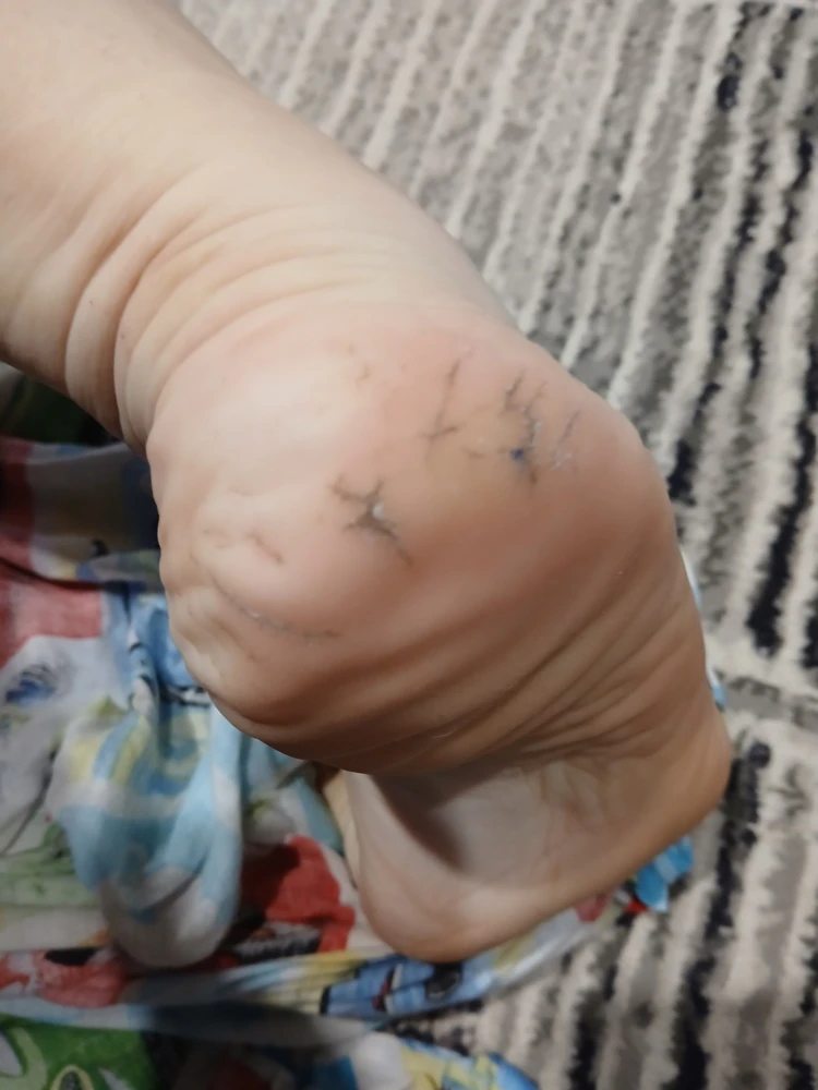 П’ята Тамари після догляду
